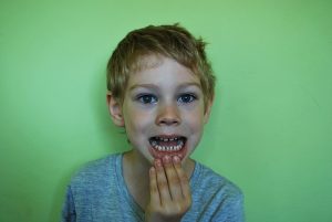 Child Showing His Teeth