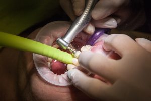 Patient getting a dental filling