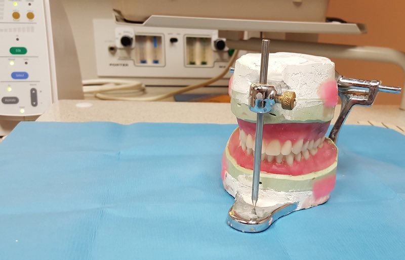 Example of dentures sitting on a dentist's table.