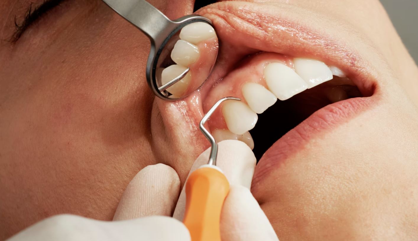 Dental implant checkup