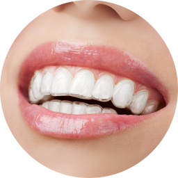 Closeup of a smile with invisalign