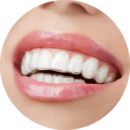 Closeup of a smile with invisalign
