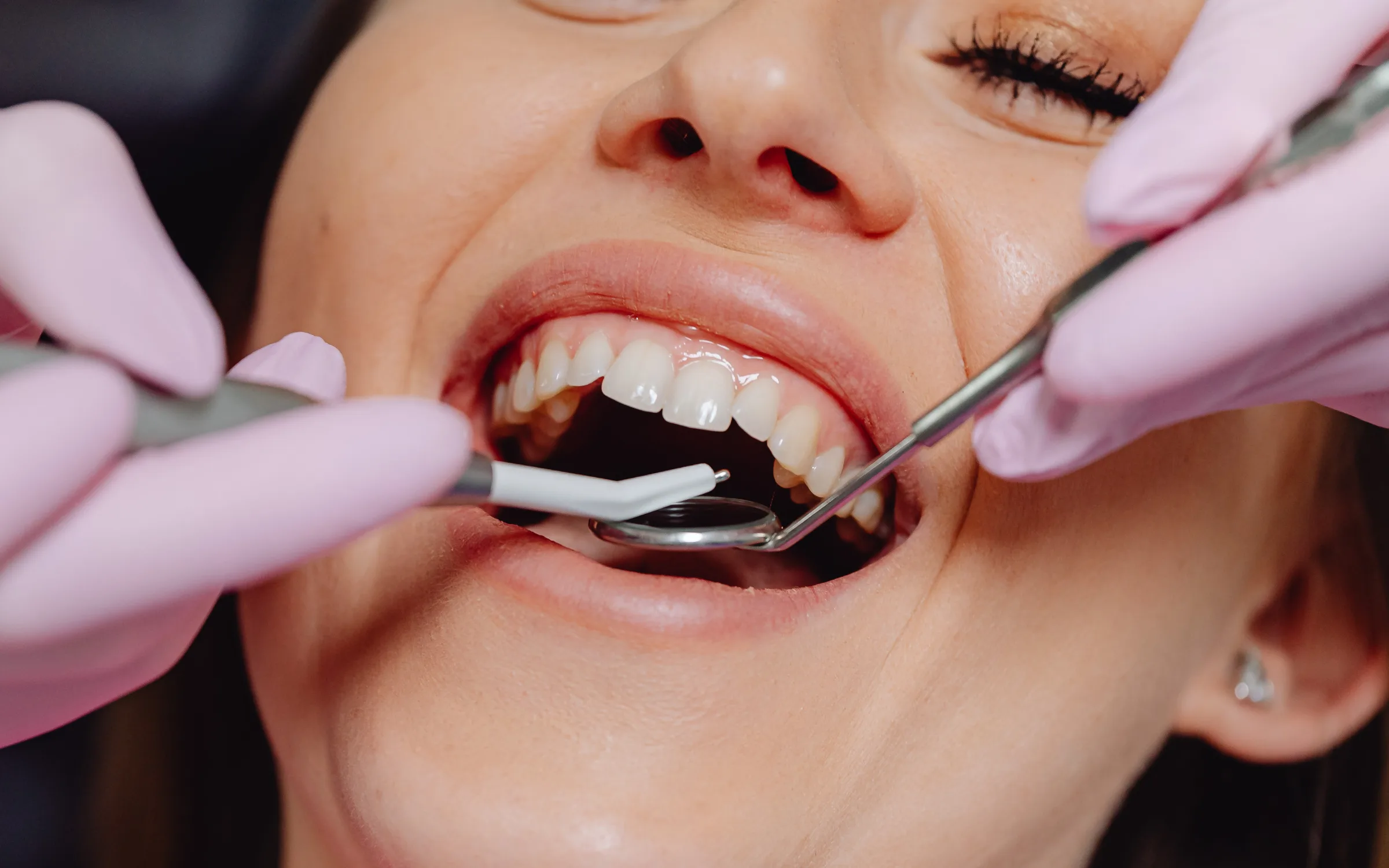 A bright, natural-looking smile during a dental exam A bright, natural-looking smile during a dental exam